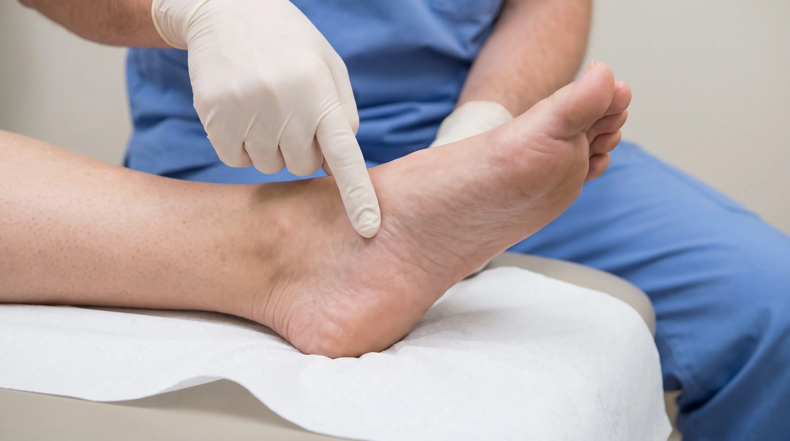 A close-up clinical photograph of a healthcare professional examining the plantar arch of a foot, pointing to the medial longitudinal arch area, soft medical lighting.