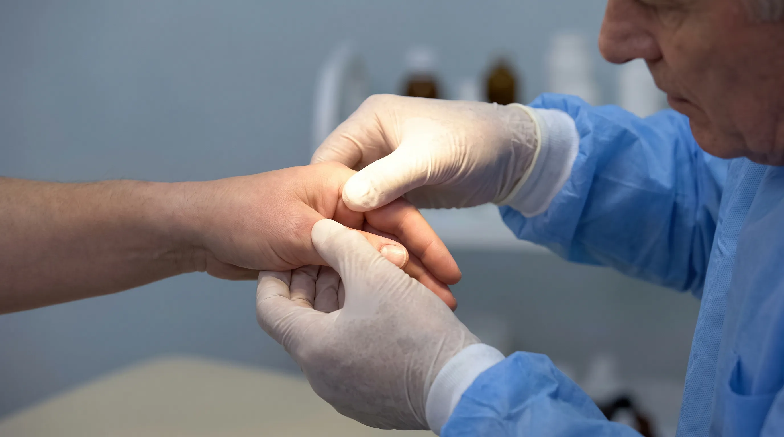 Close-up of a hand being gently evaluated by an orthopedic specialist for thumb alignment and swelling