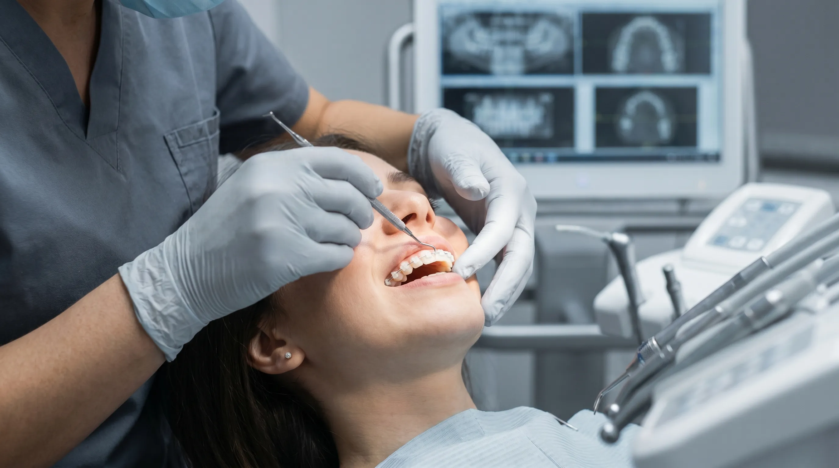 A dental professional carefully adjusting a clear archwire on ceramic brackets mounted on a patient's teeth, highlighting the precise clinical process and discreet aesthetic of modern orthodontics.