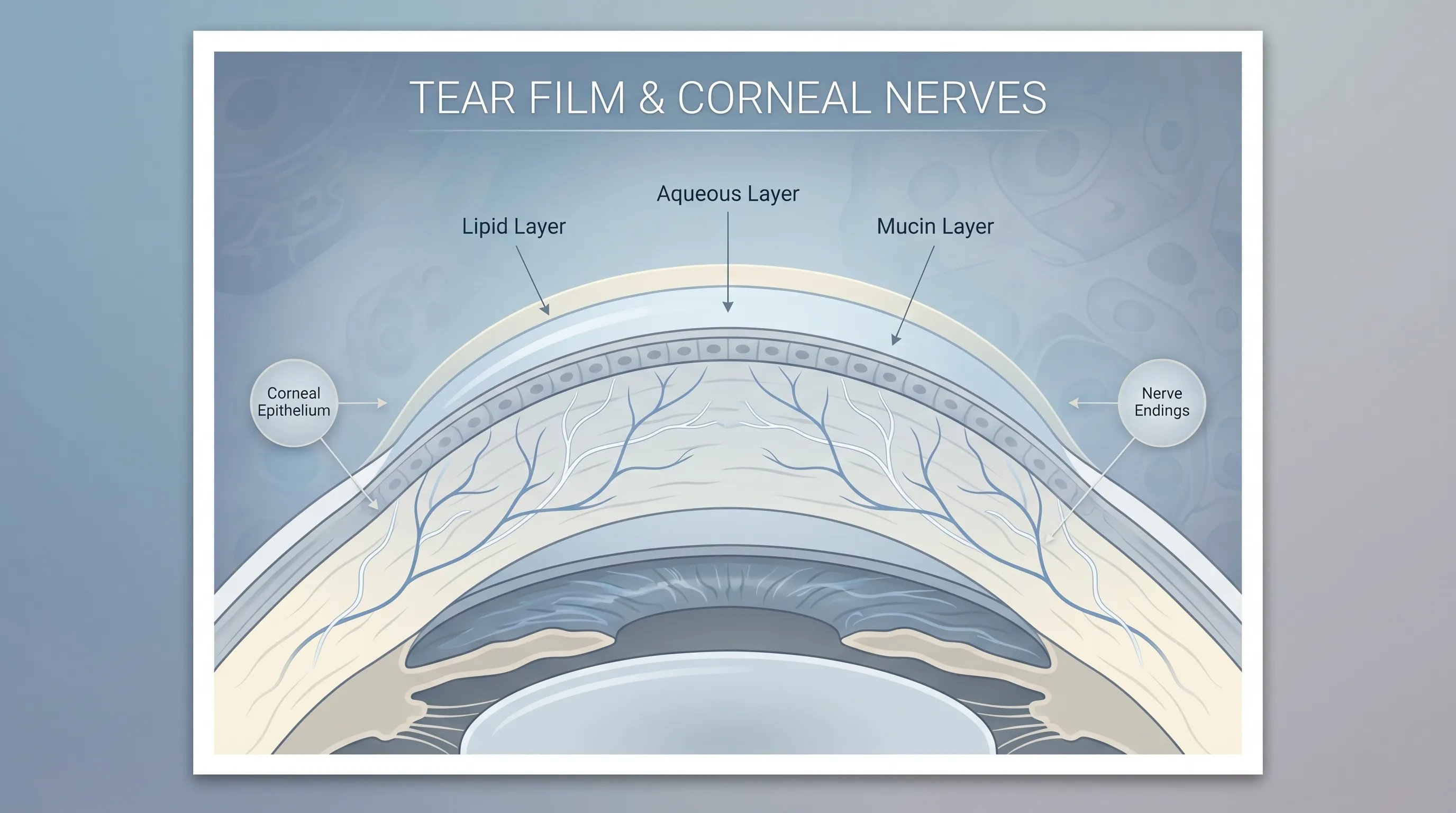 Close-up clinical illustration showing tear film layers over the cornea with nerve ending overlays