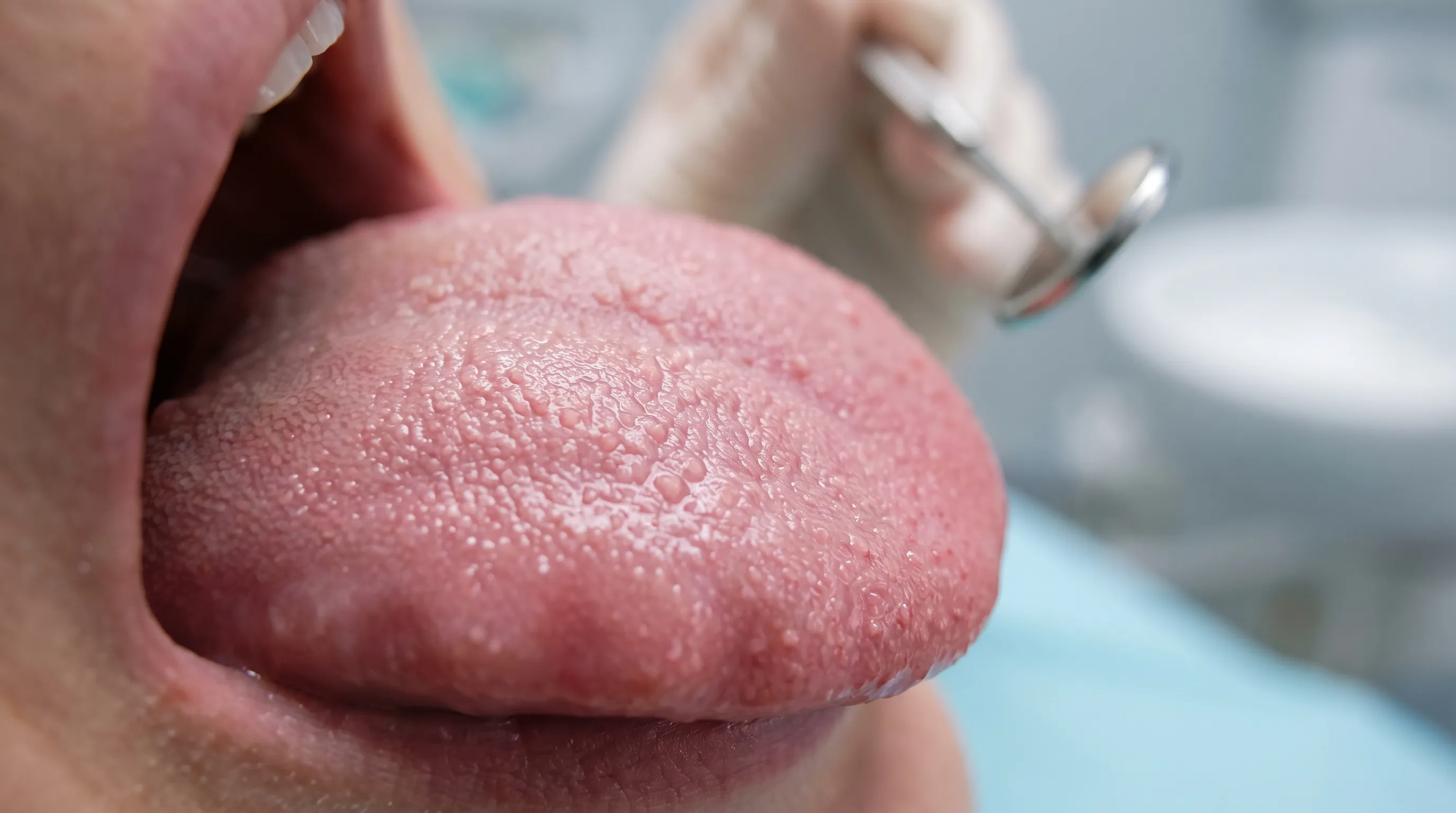 Close-up clinical photograph of a healthy human tongue under soft medical lighting, highlighting natural papillae texture, clean and educational, 4:3 ratio