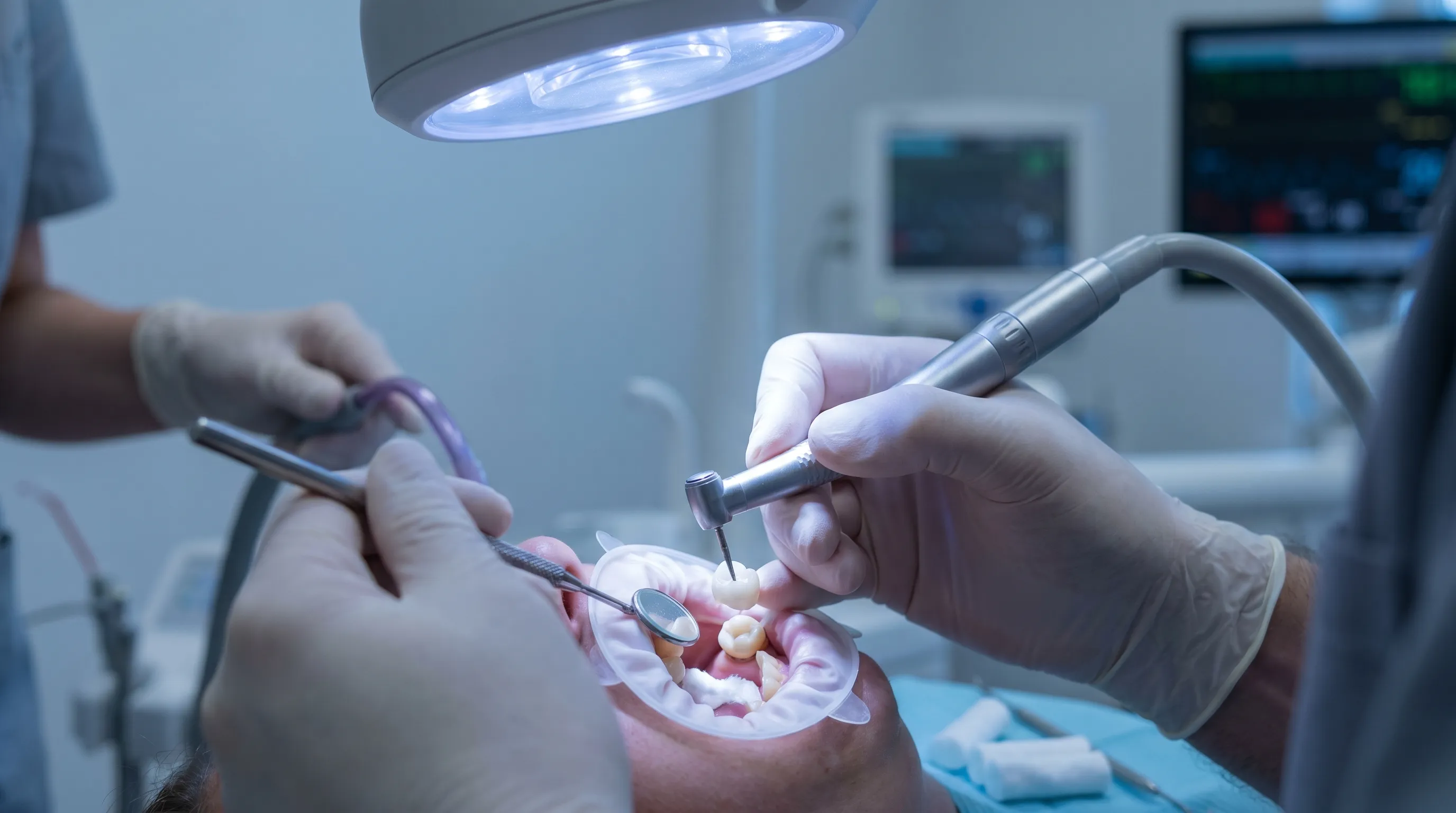 A close-up clinical photograph of a dentist using dental instruments to trim and adjust a white acrylic temporary cap over a prepared tooth, soft blue lighting, professional dental context