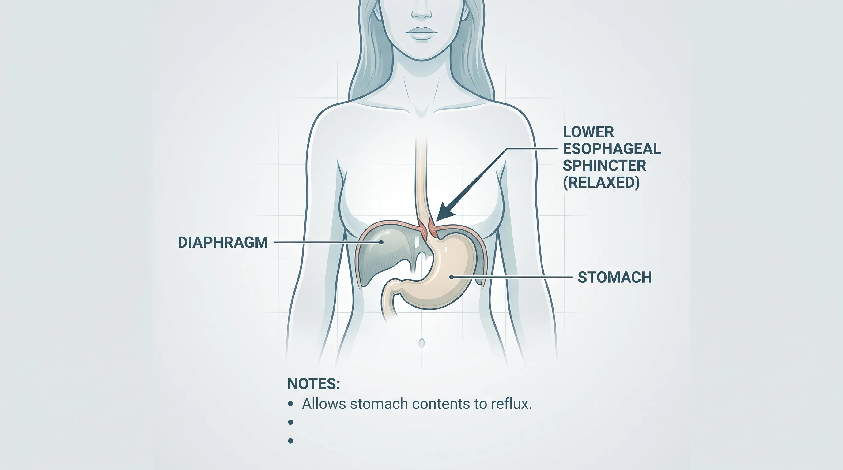 A medical illustration showing a woman's diaphragm and stomach with relaxed lower esophageal sphincter, soft clinical tones, professional healthcare infographic style